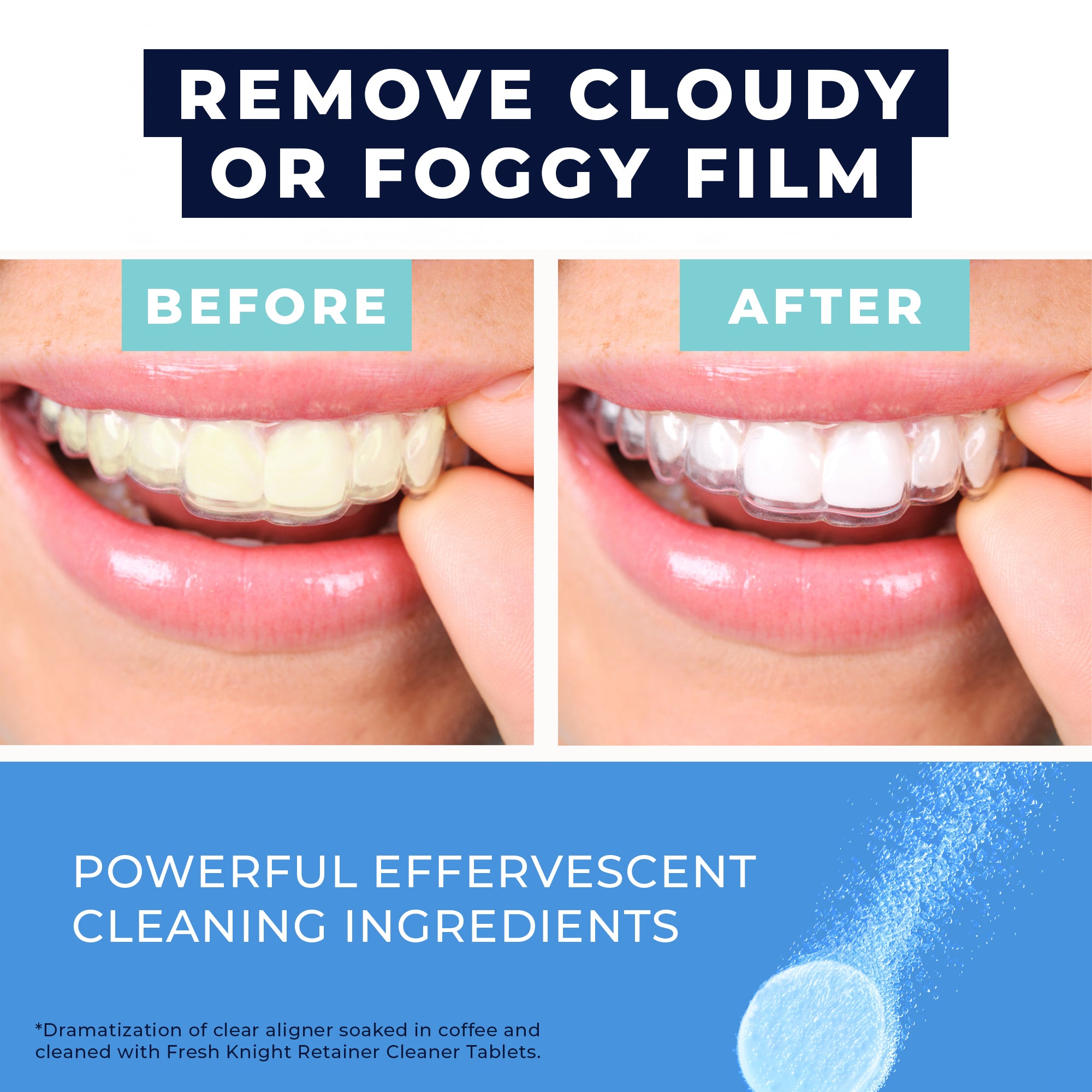Retainer & Denture Cleaner (120 Tablets)
