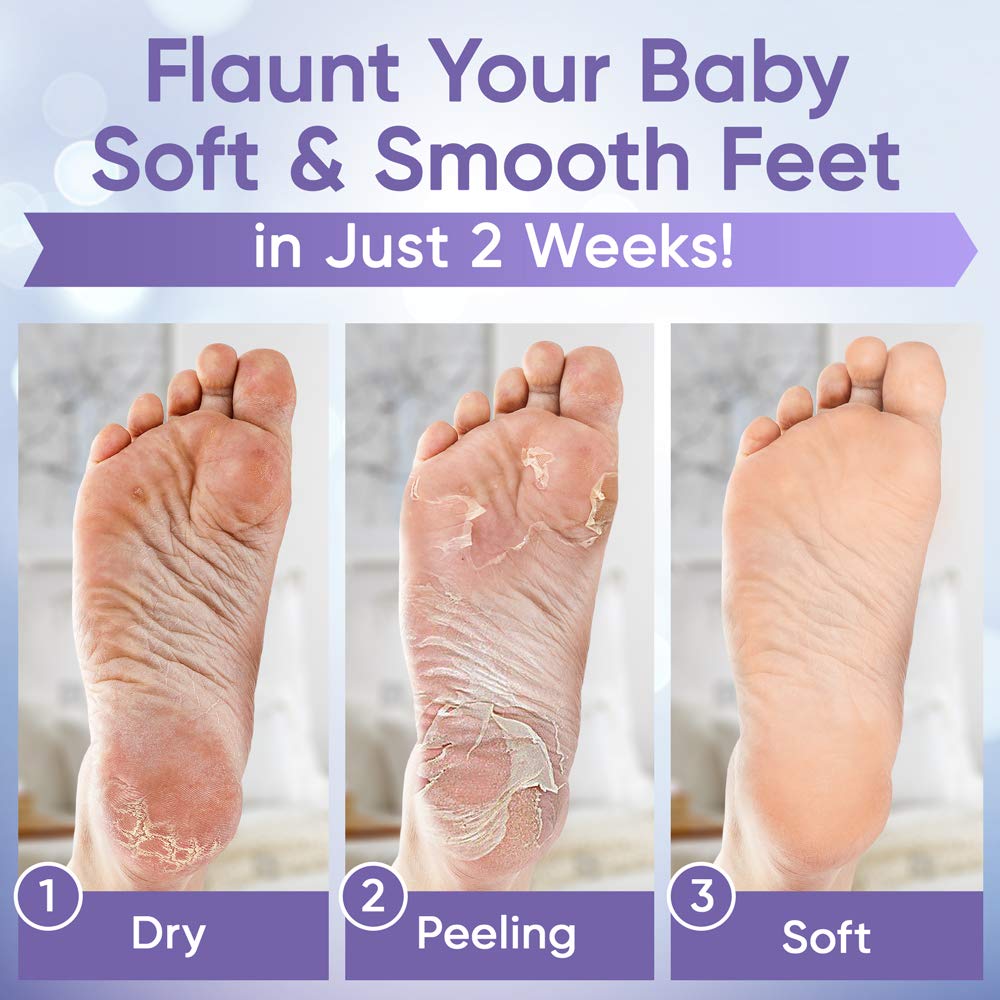 ﻿Foot Peel Mask
