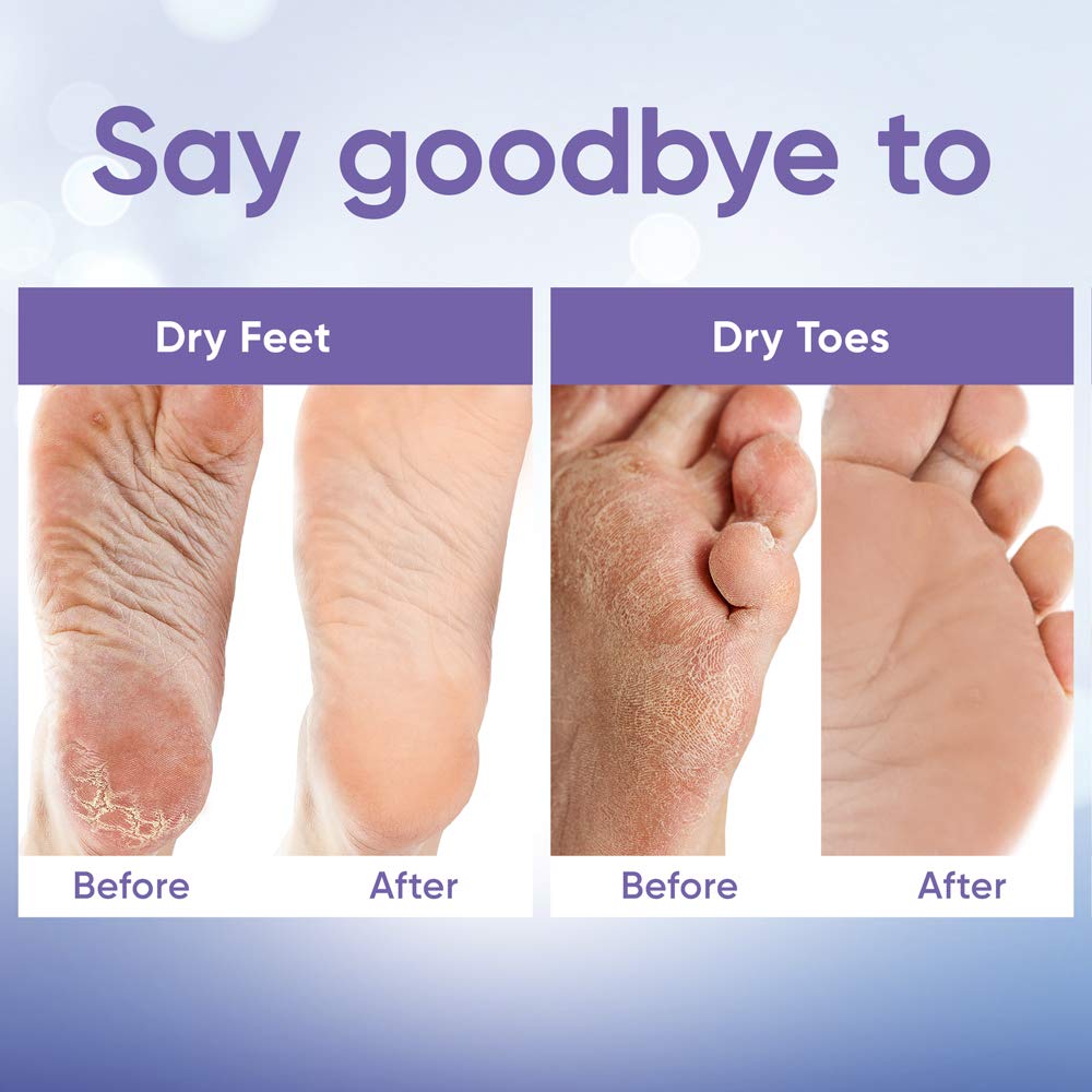 ﻿Foot Peel Mask