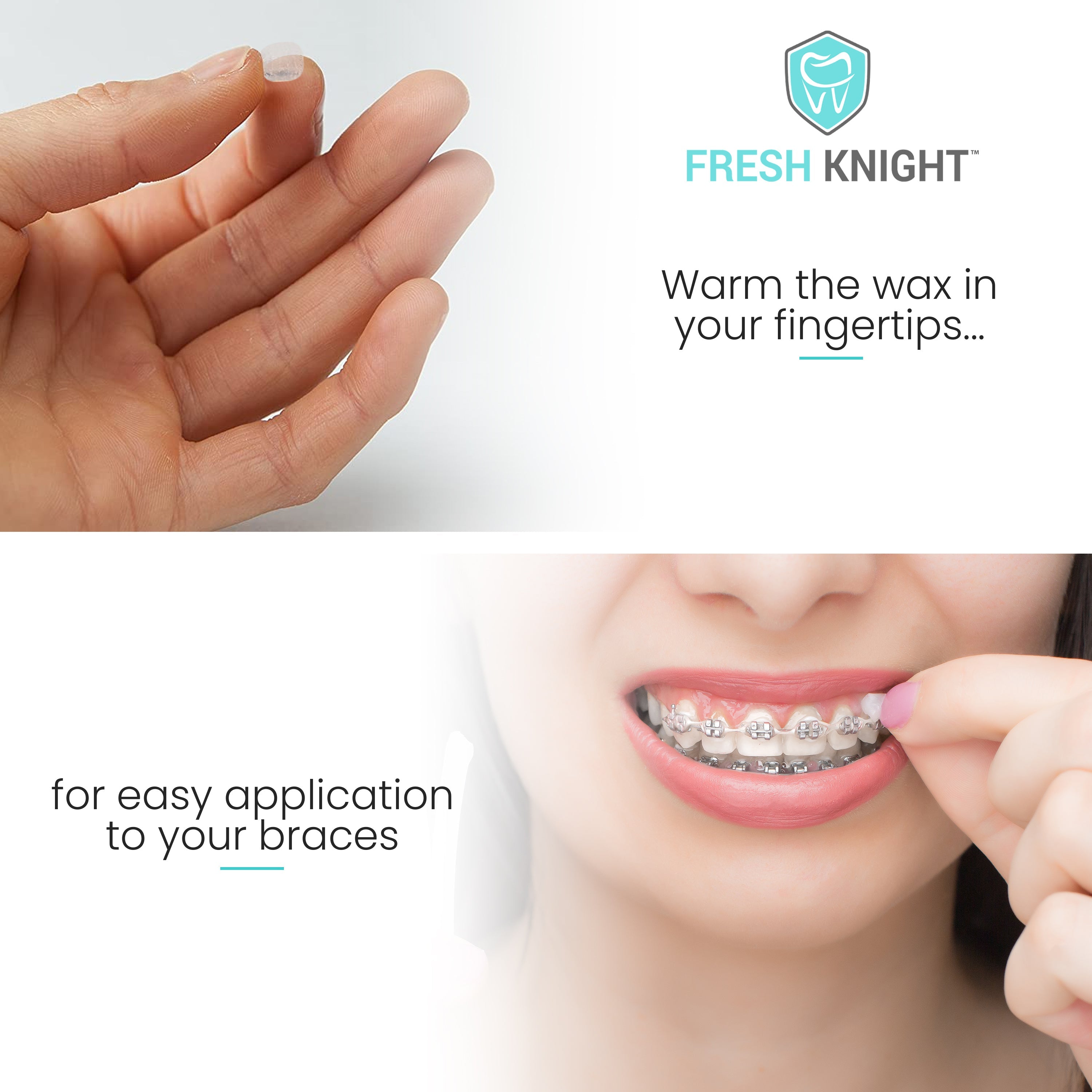 Premium Braces Wax- 10 pack Fun & Bright Colors with FREE storage case.